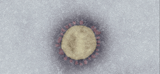 SARS-Coronavirus-2 (SARS-CoV-2, Isolat SARS-CoV-2/Italy-INMI1). Elektronenmikroskopie, Negativkontrastierung (PTA). Ma&szlig;stab: 100 nm (Foto: Robert Koch-Institut)