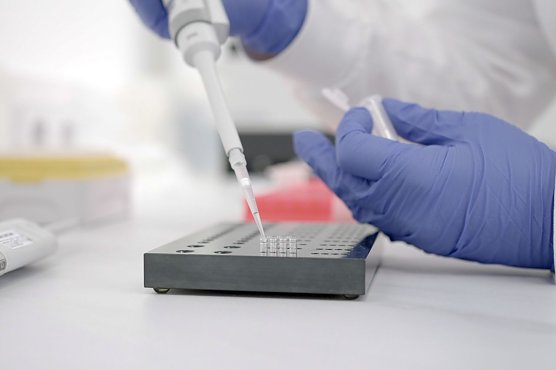 Unter dem Mikroskop fielen weder Federn, Borsten, Haare noch Horn auf (Foto: Stiftung Warentest)