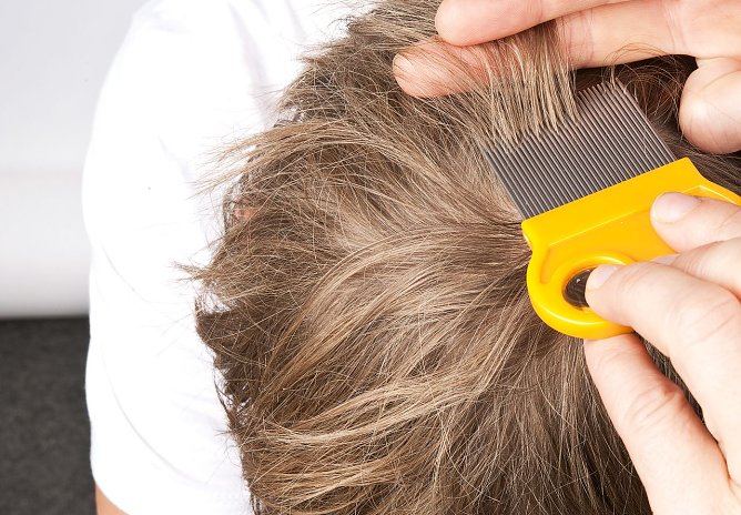 Mittel gegen L&auml;use  (Foto: Stiftung Warentest)